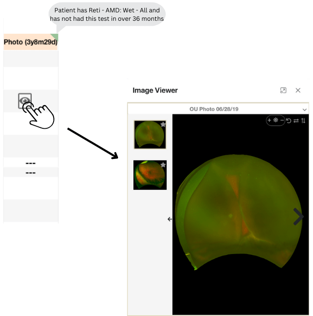Glaucoma Dashboard Image Viewer