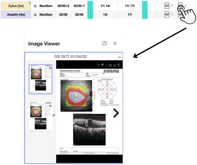 Complex Retina Patient's Image Viewer Within Retina Dashboard